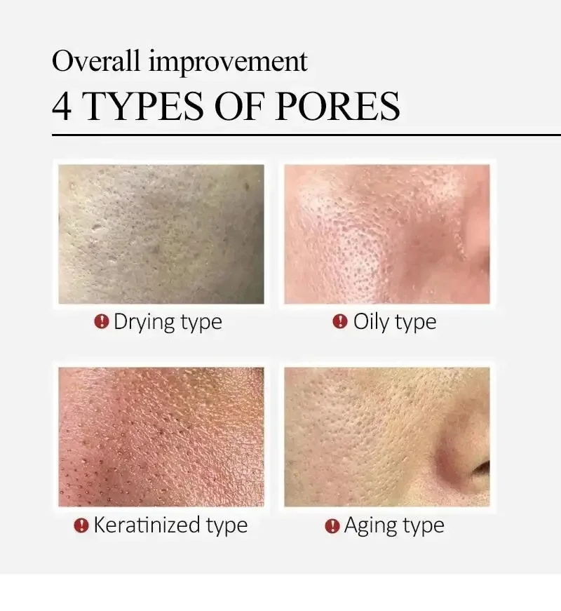 센텔라 아시아티카 모공 축소 페이스 세럼, 얼굴 붉은기 - Luxury Skincare Korea 리뷰 및 가격