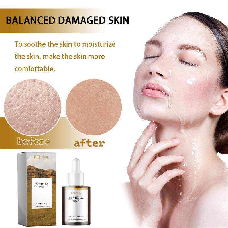 센텔라 아시아티카 모공 축소 페이스 세럼, 얼굴 붉은기 - Luxury Skincare Korea 리뷰 및 가격